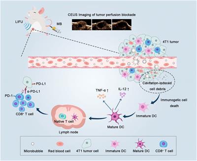 Low-intensity focused ultrasound targeted microbubble destruction reduces tumor blood supply and sensitizes anti-PD-L1 immunotherapy